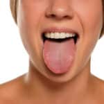 Lenire Tinnitus Treatment Tongue Stimulator